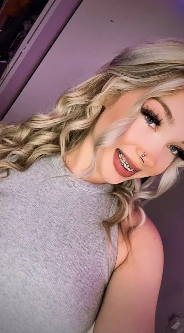 m/brace face freak (@drippyygirl) Braces OnlyFans model sexy picture wearing gray top